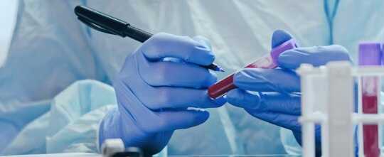 Laboratory diagnostics test technician hands blood 698x221